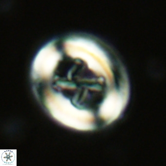 Chiasmolithus solitus VR 02625