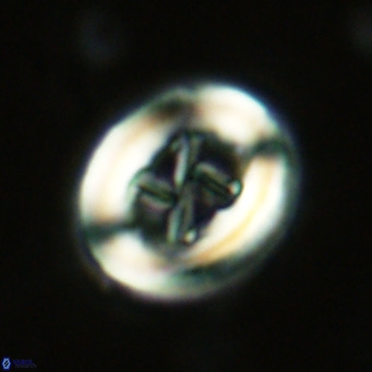 Chiasmolithus solitus VR 02626