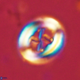 Chiasmolithus solitus VR 02627