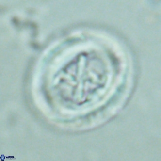 Chiasmolithus solitus VR 02628