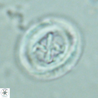 Chiasmolithus solitus VR 02628