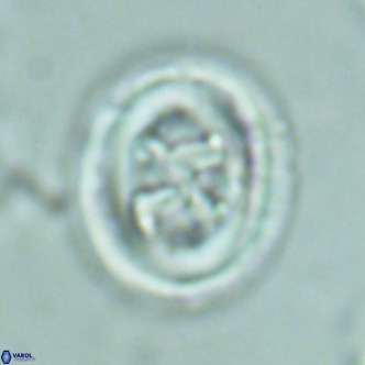 Chiasmolithus solitus VR 02629