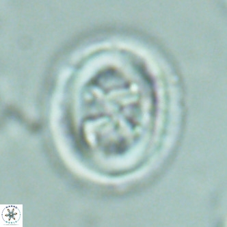 Chiasmolithus solitus VR 02629