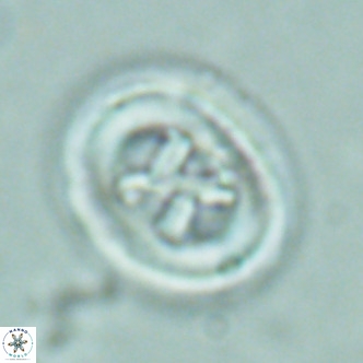 Chiasmolithus solitus VR 02632