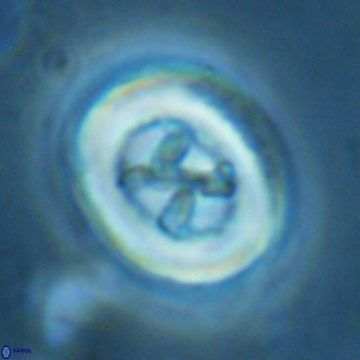 Chiasmolithus solitus VR 02633