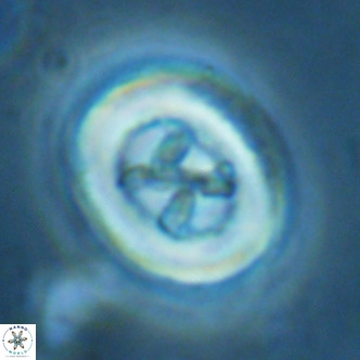 Chiasmolithus solitus VR 02633
