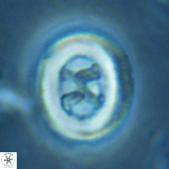 Chiasmolithus solitus VR 02634