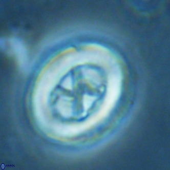 Chiasmolithus solitus VR 02635