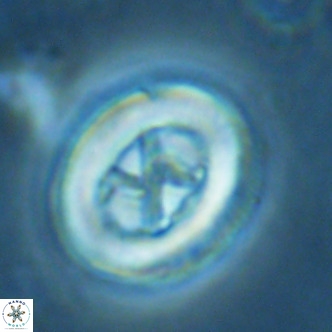 Chiasmolithus solitus VR 02635