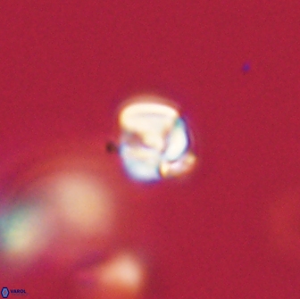 Chiasmolithus sp 63919