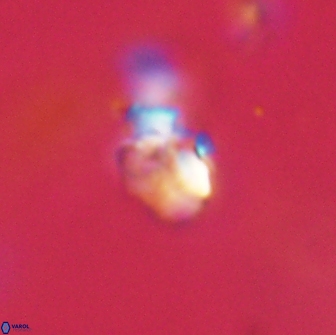 Chiasmolithus sp 63925