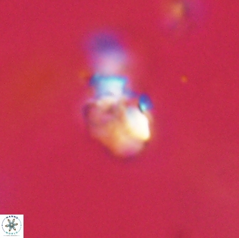 Chiasmolithus sp 63925