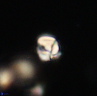 Chiasmolithus sp 63920