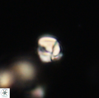 Chiasmolithus sp 63920
