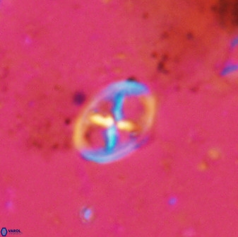 Chiastozygus amphipons 42426