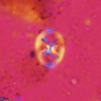 Chiastozygus amphipons 42428