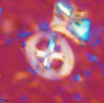 Chiastozygus bifarius 13937