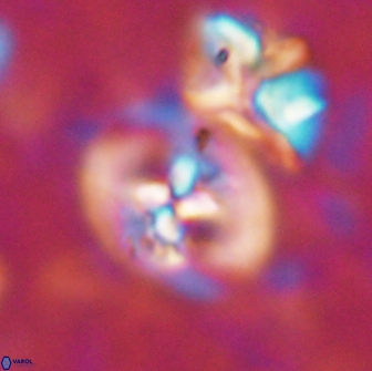 Chiastozygus bifarius 13938