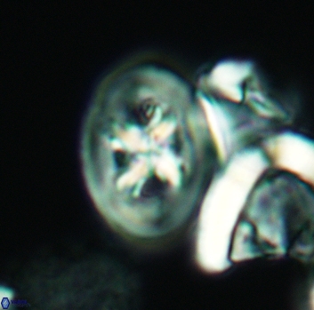 Chiastozygus bifarius 3129