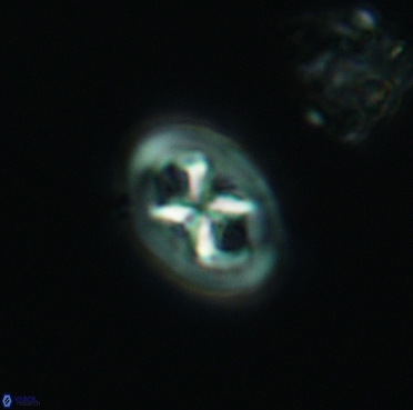 Chiastozygus bifarius 3379