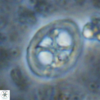Chiastozygus fessus 13954