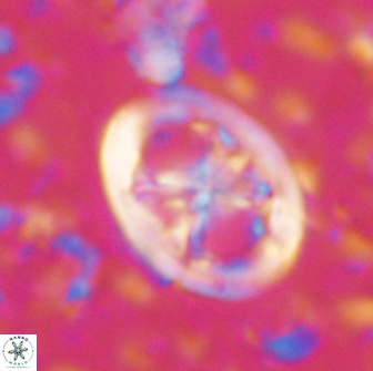 Chiastozygus fessus 13957