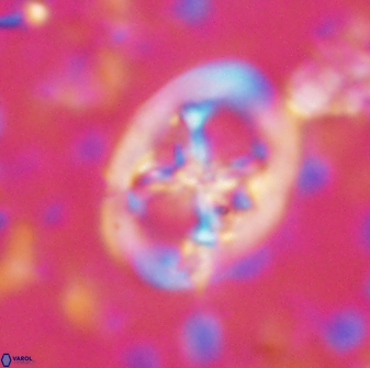 Chiastozygus fessus 13966