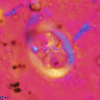 Chiastozygus fessus 6144