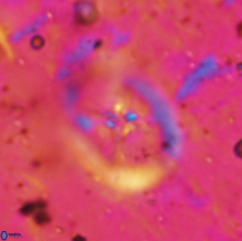 Chiastozygus fessus 6146