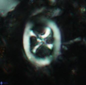 Chiastozygus fessus 6147