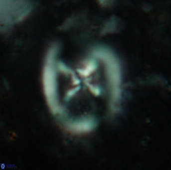 Chiastozygus fessus 6149