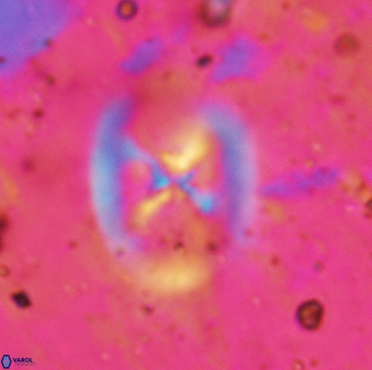 Chiastozygus fessus 6150