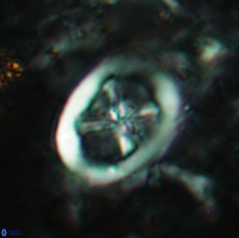 Chiastozygus fessus 6151