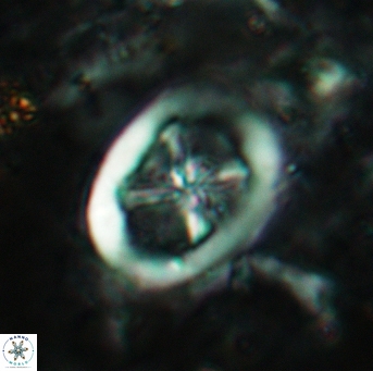 Chiastozygus fessus 6151
