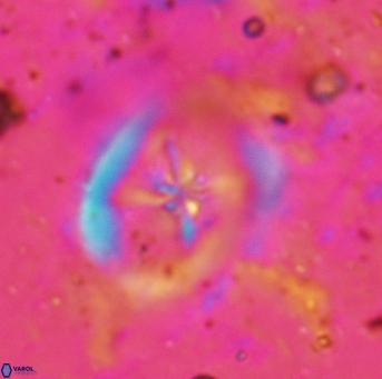 Chiastozygus fessus 6153