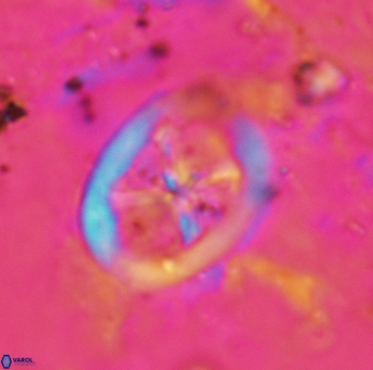 Chiastozygus fessus 6154