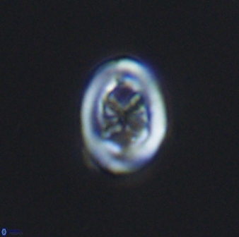 Chiastozygus spissus 7885