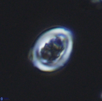 Chiastozygus spissus 7886