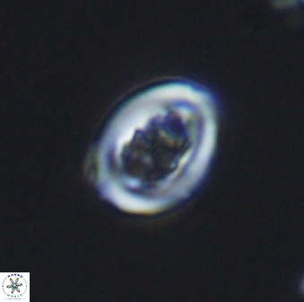 Chiastozygus spissus 7886