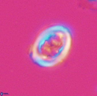 Chiastozygus spissus 7887