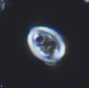 Chiastozygus spissus 7882