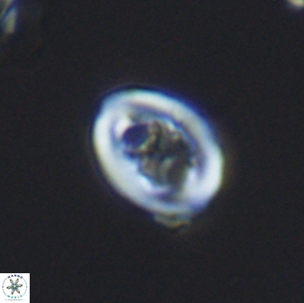 Chiastozygus spissus 7882
