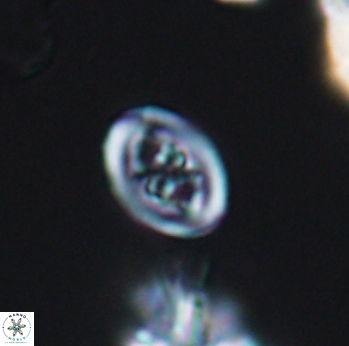 Chiastozygus spissus 8040