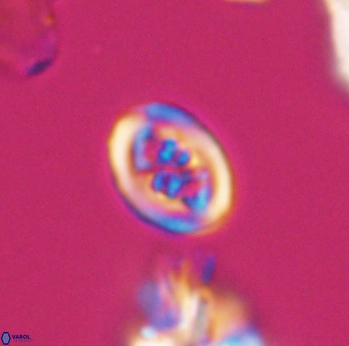 Chiastozygus spissus 8041