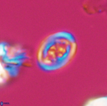 Chiastozygus spissus 8042