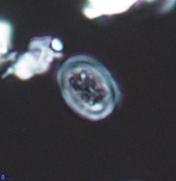 Chiastozygus spissus 11294