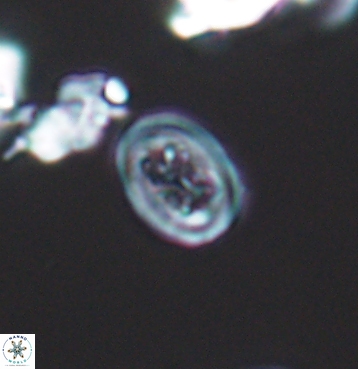 Chiastozygus spissus 11294
