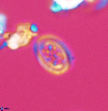 Chiastozygus spissus 11295