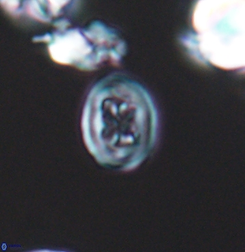 Chiastozygus spissus 11296