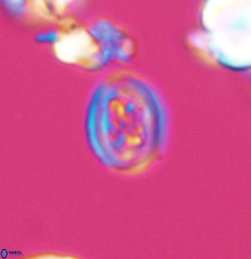 Chiastozygus spissus 11297